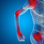 L'importanza della fisioterapia contro il dolore