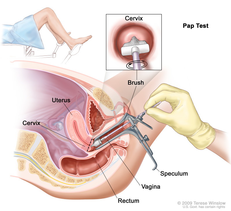 Pap test - procedura illustrata del prelievo delle cellule uterine