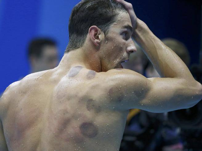 Michael Phelps with cupping's signs at Rio 2016