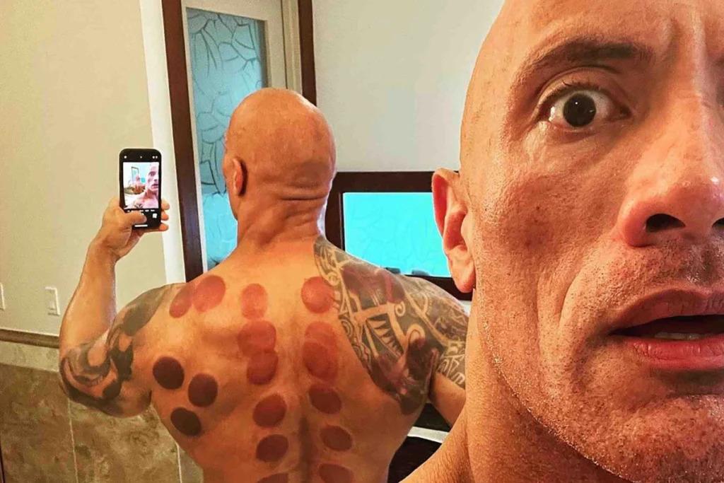 Dwayne "The Rock" Johnson with cupping's signs