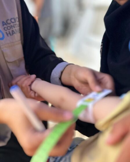 Gli ultimi dati IPC mostrano oltre 20mila bambini malnutriti a Gaza. Foto di Juman Tamimi per Azione Contro la Fame.