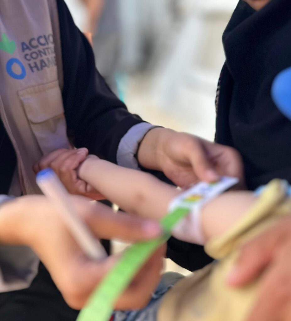 Gli ultimi dati IPC mostrano oltre 20mila bambini malnutriti a Gaza. Foto di Juman Tamimi per Azione Contro la Fame.